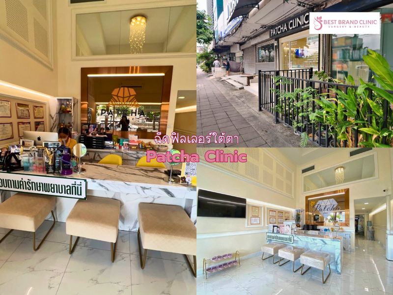 คลินิกฉีด Filler ใต้ตา ที่ไหนดี Patcha Clinic