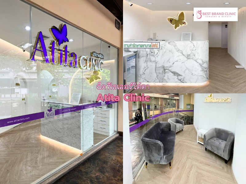 คลินิกเติม Filler ใต้ตา ที่ไหนดี Atita Clinic