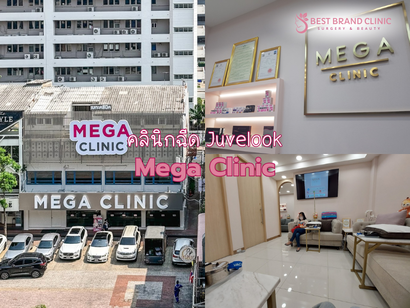 คลินิกฉีด Juvelook ทำที่ไหนดี Mega Clinic