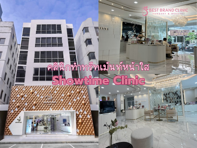 คลินิกทรีทเม้นท์หน้าขาวใส เลือกที่ไหนดี Showtime Clinic