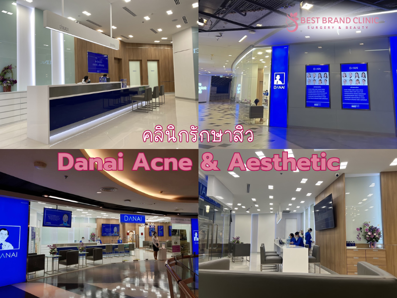 คลินิกรักษาสิว ทำที่ไหนดี Danai Acne & Aesthetic