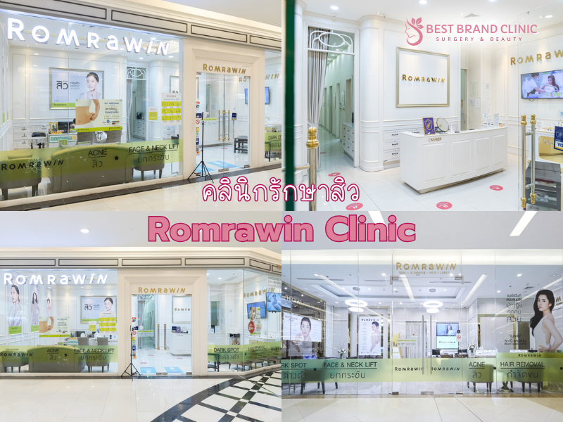 คลินิกรักษาสิว ที่ไหนเห็นผล Romrawin Clinic