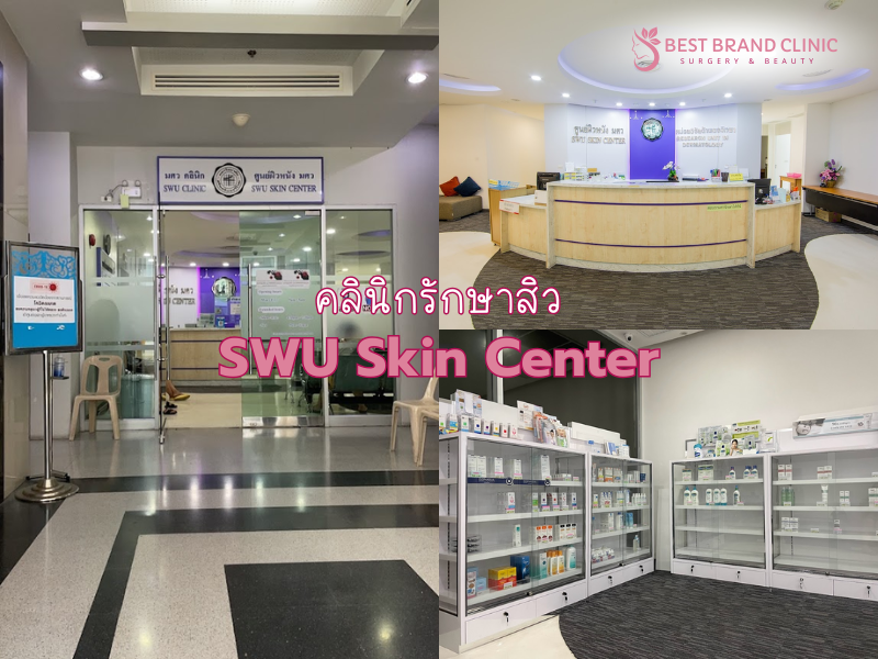 ศูนย์ผิวหนังรักษาสิว ที่ไหนดี SWU Skin Center