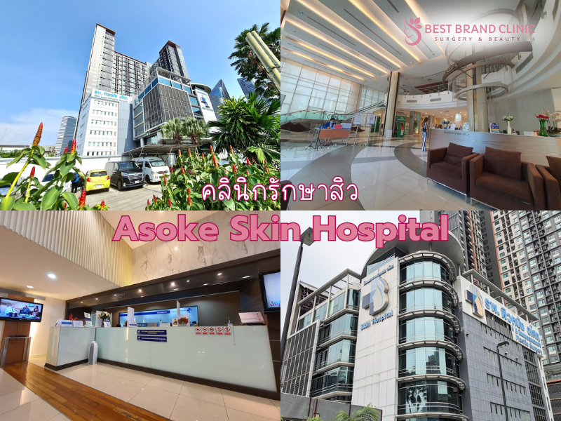 โรงพยาบาลรักษาสิว ที่ไหนดี Asoke Skin Hospital