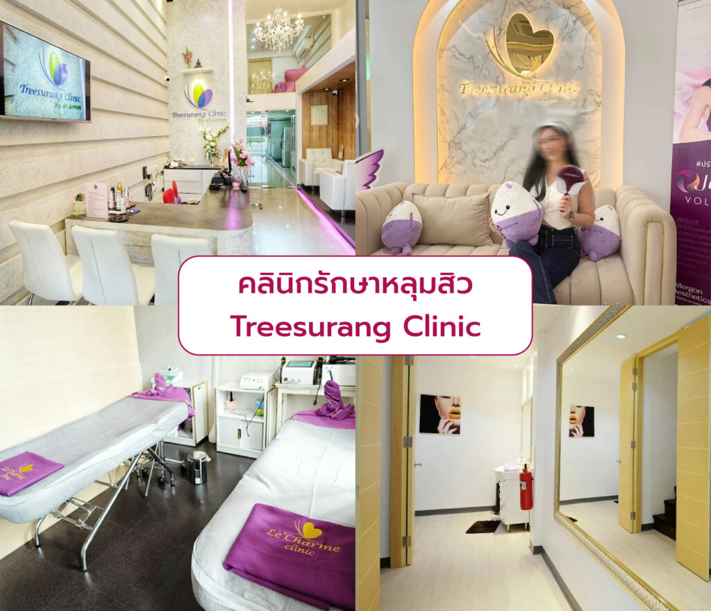 คลินิก Laser หลุมสิว เลือกที่ไหนดี Treesurang Clinic