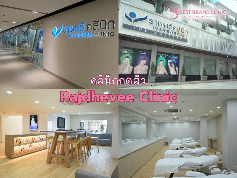 คลินิกกดสิวฉีดสิว ทำที่ไหนดี Rajdhevee Clinic