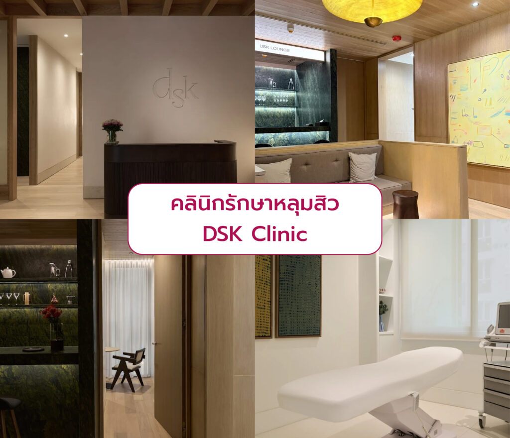 คลินิกทำหลุมสิว รักษาที่ไหนดี DKS Clinic