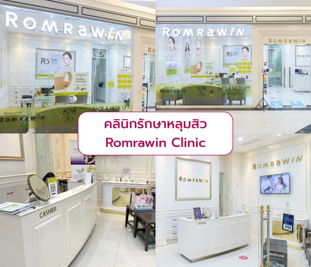 คลินิกรักษาหลุมสิว ที่ไหนดี Romrawin Clinic