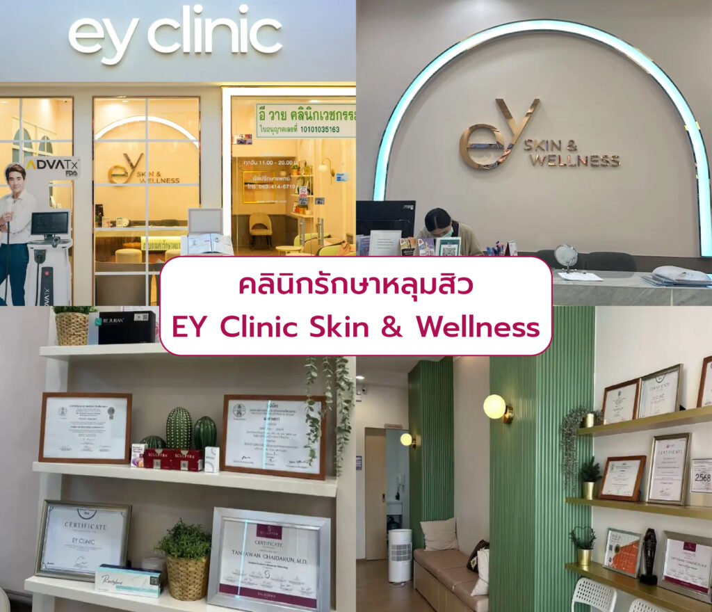 คลินิกรักษาหลุมสิว เลือกที่ไหนดี EY Clinic Skin & Wellness