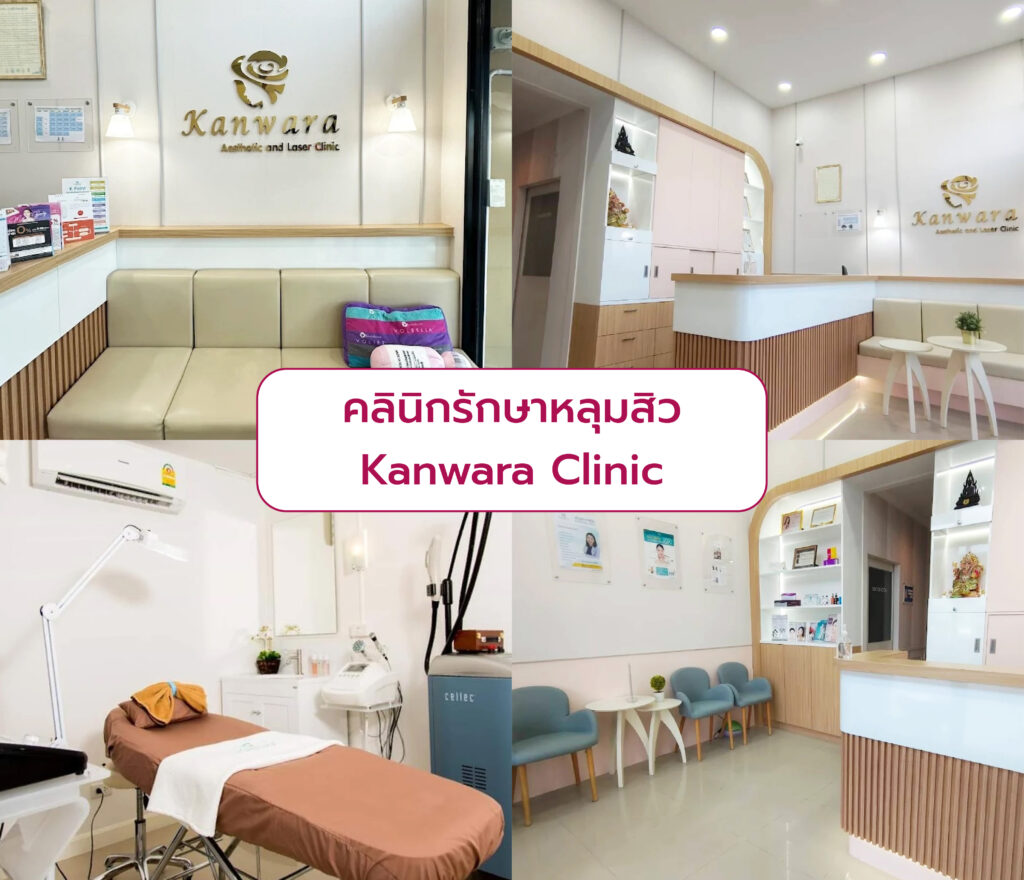 คลินิกเลเซอร์รักษาหลุมสิว ที่ไหนดีที่สุด Kanwara Clinic
