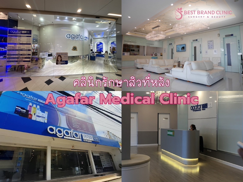 รักษาสิวที่หลัง ที่ไหนดีสุด Agafar Medical Clinic