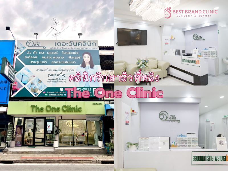 รักษาสิวที่หลัง ที่ไหนดีสุด The One Clinic