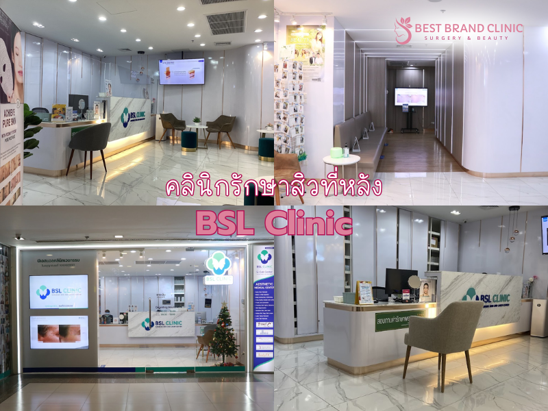 รักษาสิวหลัง ที่ดีที่สุด BSL Clinic
