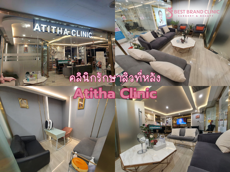 รักษาสิวหลัง ที่ไหนดี รักษาเห็นผล Atitha Clinic