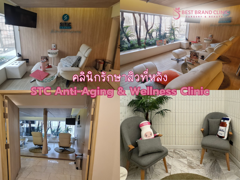 รักษาสิวหลัง เลือกที่ไหนเห็นผล STC Anti-Aging & Wellness Clinic