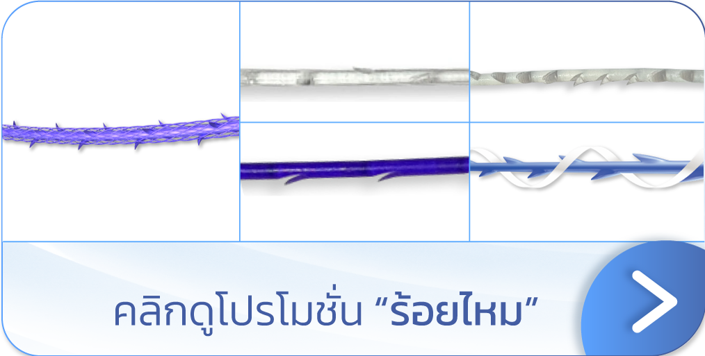 ร้อยไหมยกมุมปาก ที่ไหนดี V Square Clinic