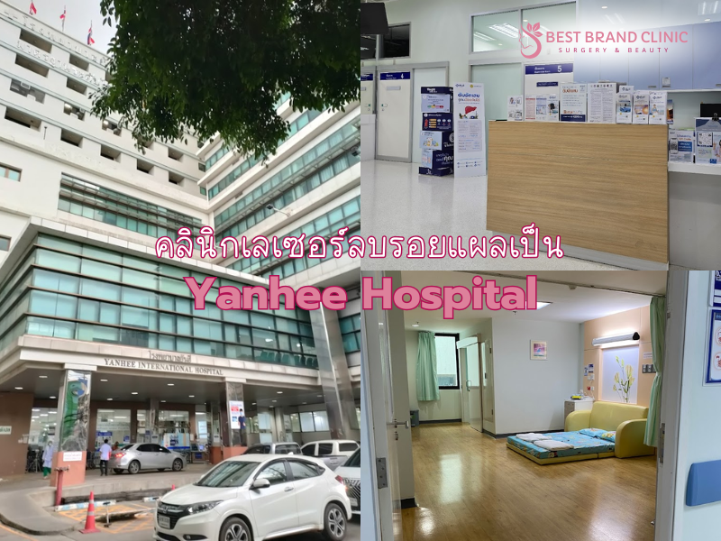 คลินิก Laser ลบรอยแผลเป็น ที่ไหนดี Yanhee Hospital