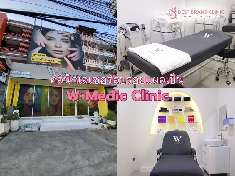 คลินิกเลเซอร์ลบรอยแผลเป็น ที่ไหนดี W+Medic Clinic