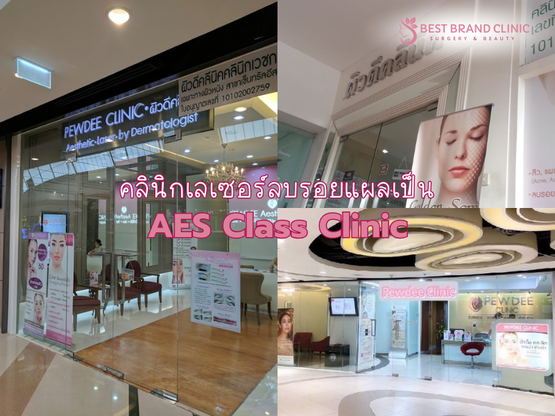 คลินิกเลเซอร์ลบรอยแผลเป็น เจ้าไหนดีที่สุด AES Class Clinic
