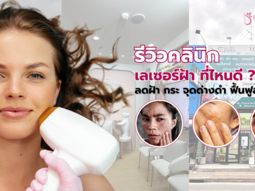 เลเซอร์ฝ้า ที่ไหนดี