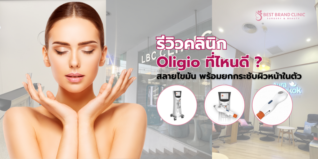 Oligio ที่ไหนดี