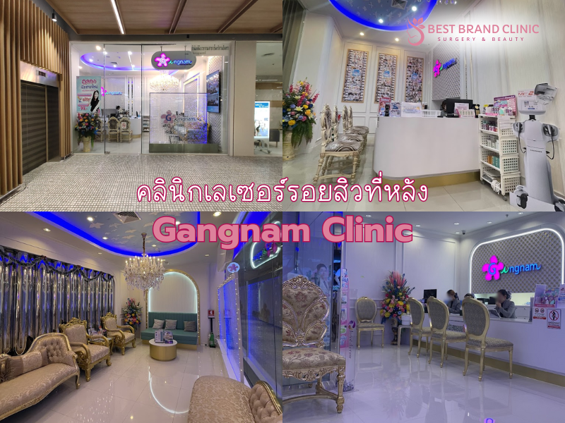 คลินิก Laser รักษารอยสิวที่หลัง ที่ไหนดี ไม่แพง Gangnam Clinic