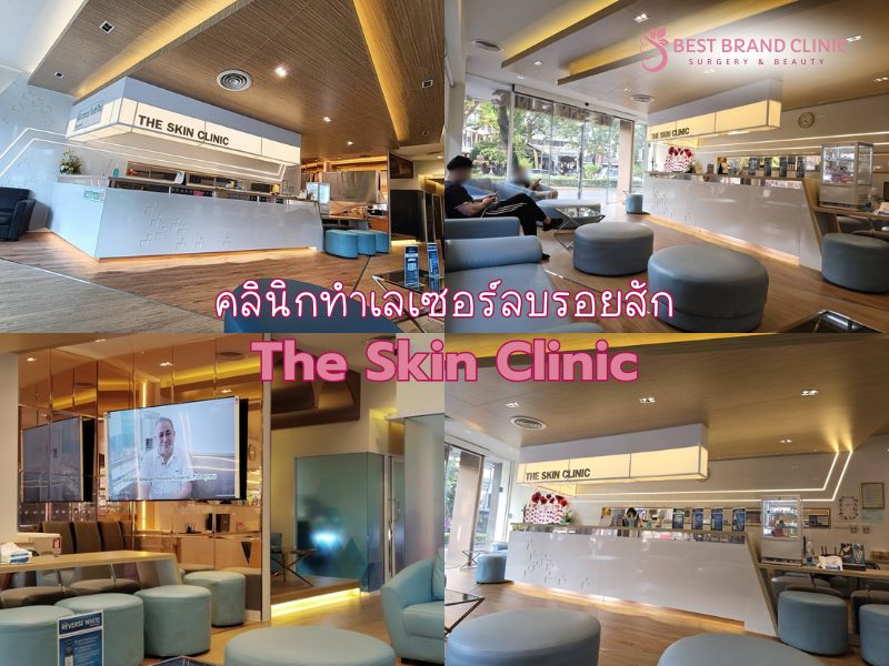 คลินิก Laser ลบรอยสัก ที่ไหนดีที่สุด The Skin Clinic