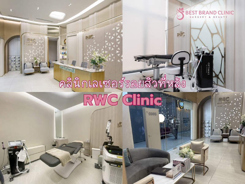 คลินิกทำเลเซอร์รอยสิวที่หลัง ที่ไหนดีสุด RWC Clinic