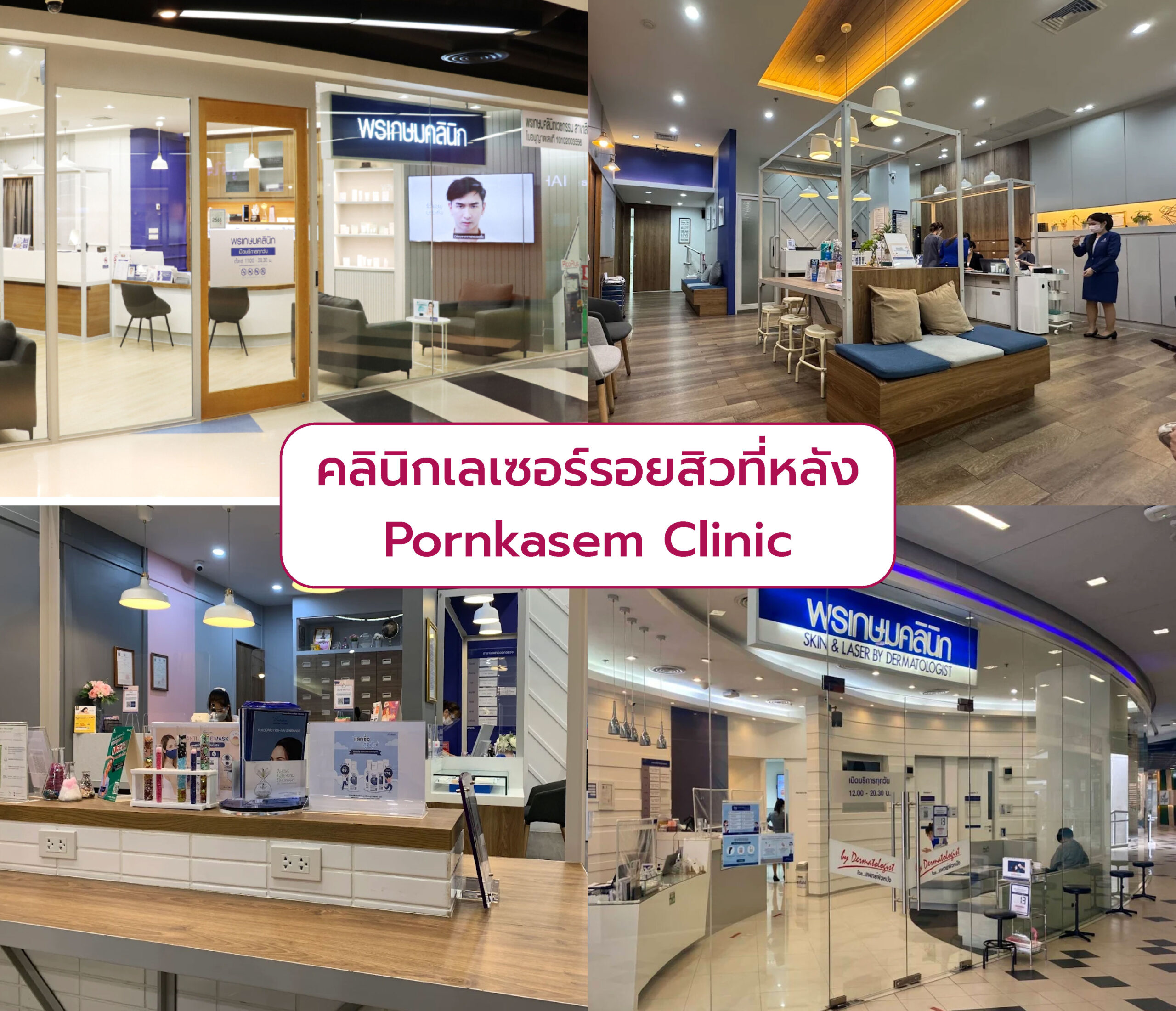 คลินิกทำเลเซอร์รอยสิวที่หลัง เลือกที่ไหนดี Pornkasem Clinic