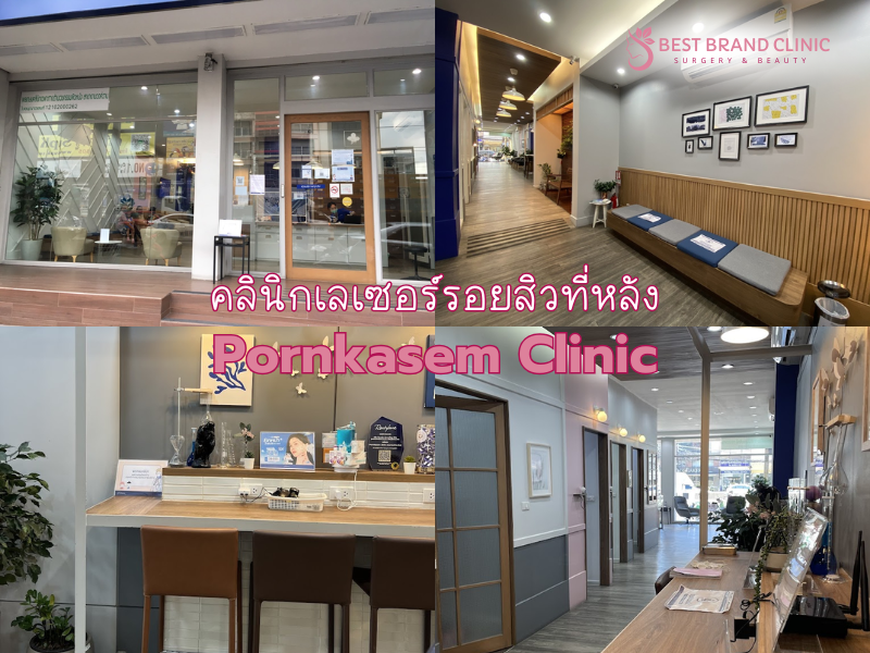 คลินิกทำเลเซอร์รอยสิวที่หลัง เลือกที่ไหนดี Pornkasem Clinic