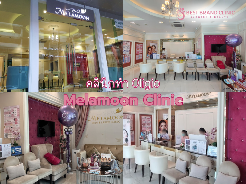 คลินิกยกกระชับ Oligio ที่ไหนทำดีเห็นผล Melamoon Clinic