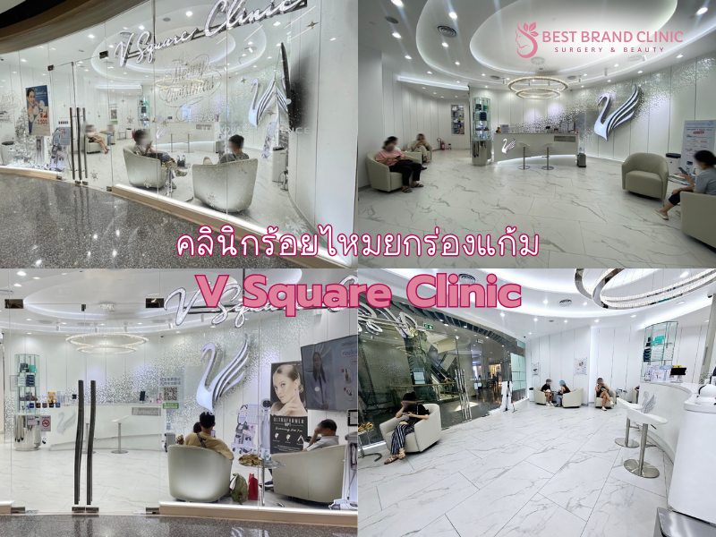คลินิกร้อยไหมยกร่องแก้ม ที่ไหนดี V Square Clinic