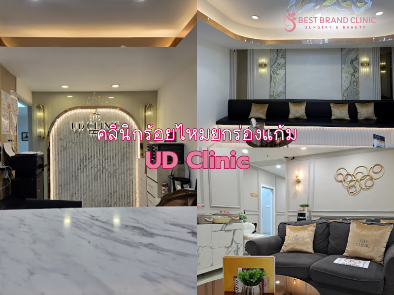 คลินิกร้อยไหมยกร่องแก้ม ที่ไหนดีสุด UD Clinic