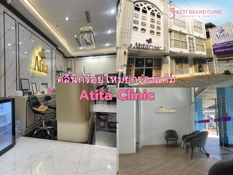 คลินิกร้อยไหมยกร่องแก้ม เลือกที่ไหนดี Atita Clinic
