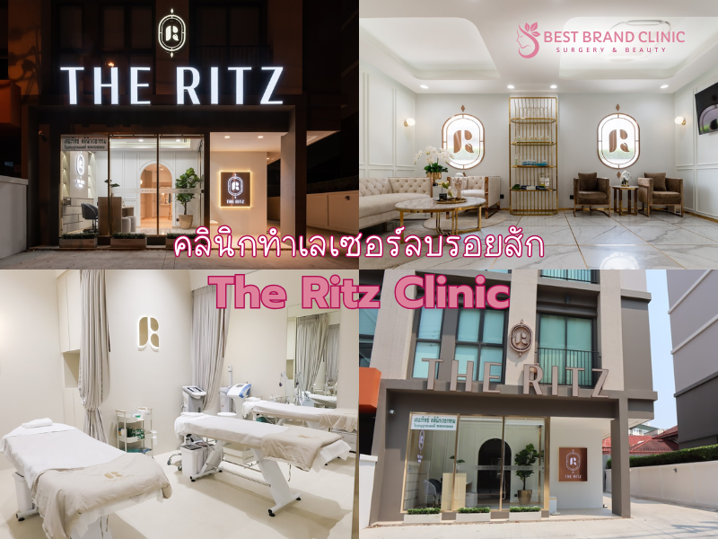 คลินิกลบรอยสัก เลือกที่ไหนดี The Ritz Clinic