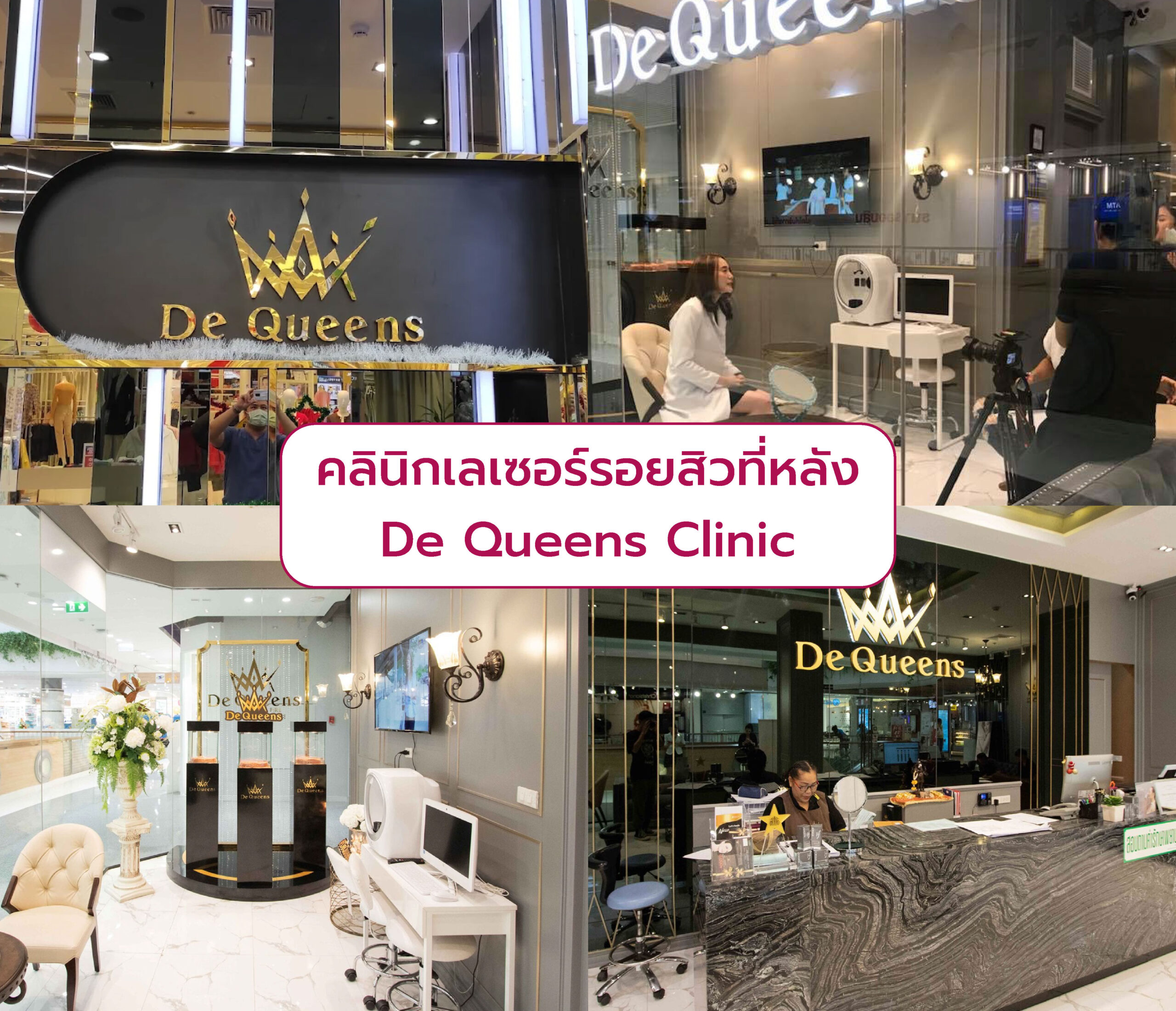 คลินิกเลเซอร์รอยสิวที่หลัง ที่ไหนดี De Queens Clinic