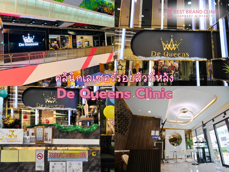 คลินิกเลเซอร์รอยสิวที่หลัง ที่ไหนดี De Queens Clinic