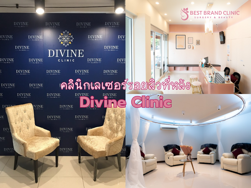 คลินิกเลเซอร์รอยสิวที่หลัง ที่ไหนดีที่สุด Divine Clinic