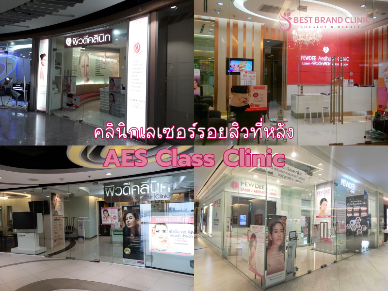 คลินิกเลเซอร์รักษารอยสิวที่หลัง เจ้าไหนดี AES Class Clinic