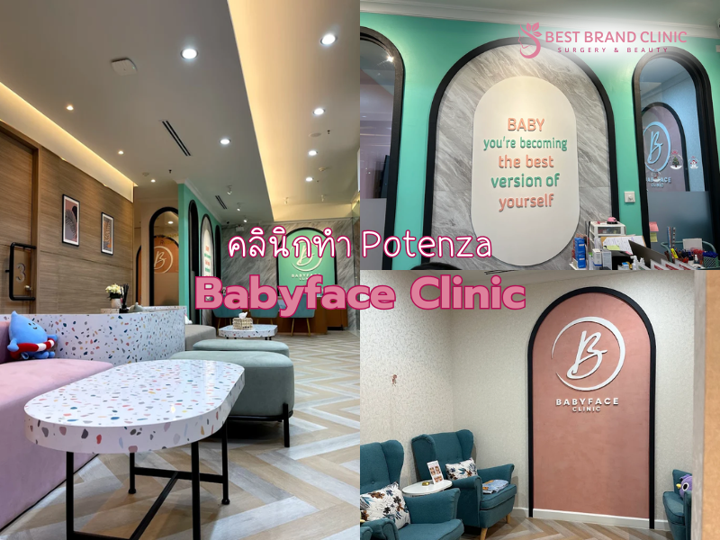 Potenza ที่ไหนดี Babyface Clinic