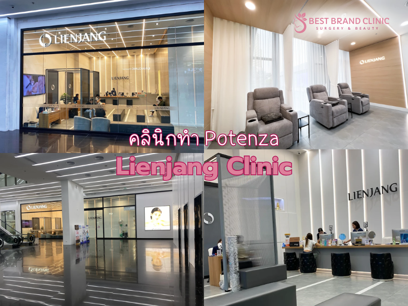 คลินิกทำ Potenza ที่ไหนดี Lienjang Clinic