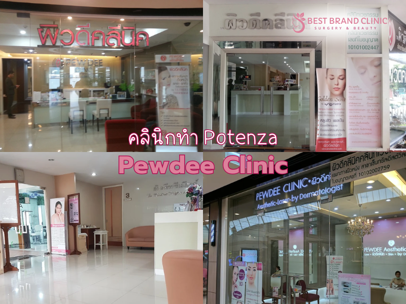 คลินิกทำ Potenza เลือกที่ไหนดี Pewdee Clinic