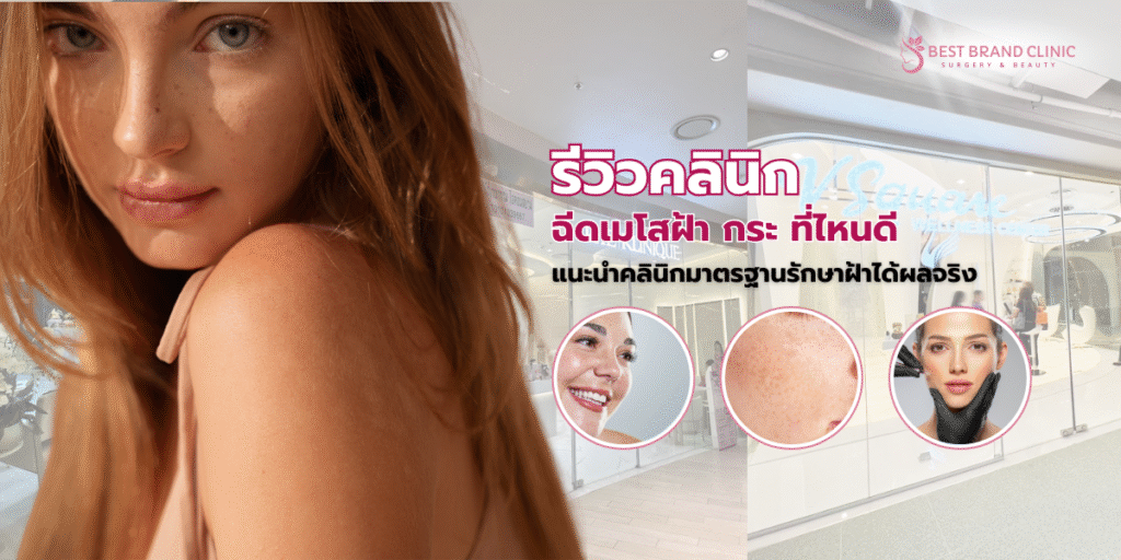 ฉีดเมโสฝ้า กระ ที่ไหนดี