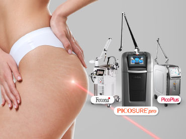 รีวิว-10-คลินิกเลเซอร์รอยแตกลาย-ที่ไหนดี370x277