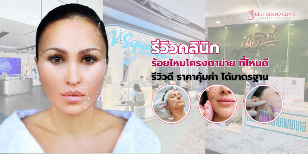 ร้อยไหมโครงตาข่าย ที่ไหนดี