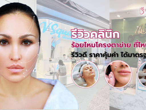 ร้อยไหมโครงตาข่าย ที่ไหนดี