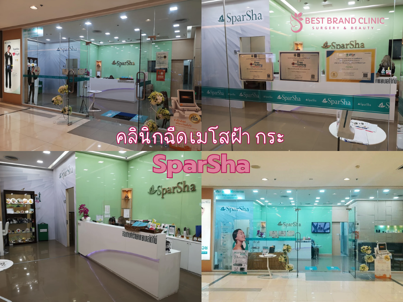 เมโสฝ้ากระ เลือกที่ไหนดี SparSha