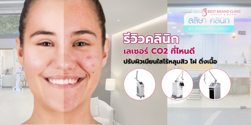 เลเซอร์ CO2 ที่ไหนดี