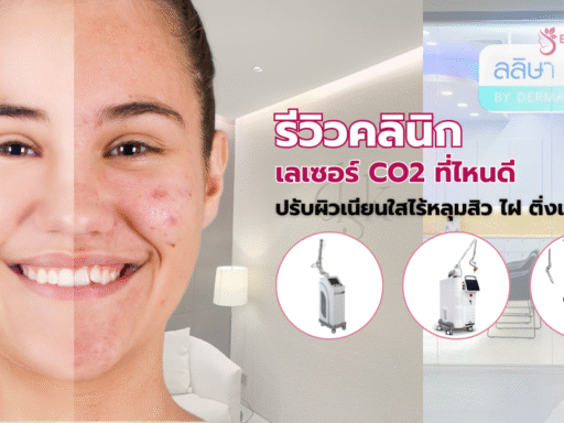 เลเซอร์ CO2 ที่ไหนดี