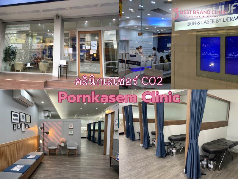 เลเซอร์ CO2 ที่ไหนดี พรเกษมคลินิก